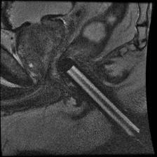 prostate_mri_3 prostate_mri_3